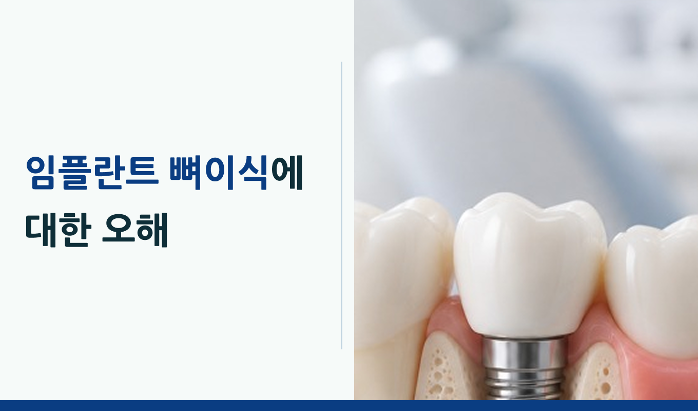 잘 심으려면 잘 채워야 한다? 수영구치과에서 알려드립니다
